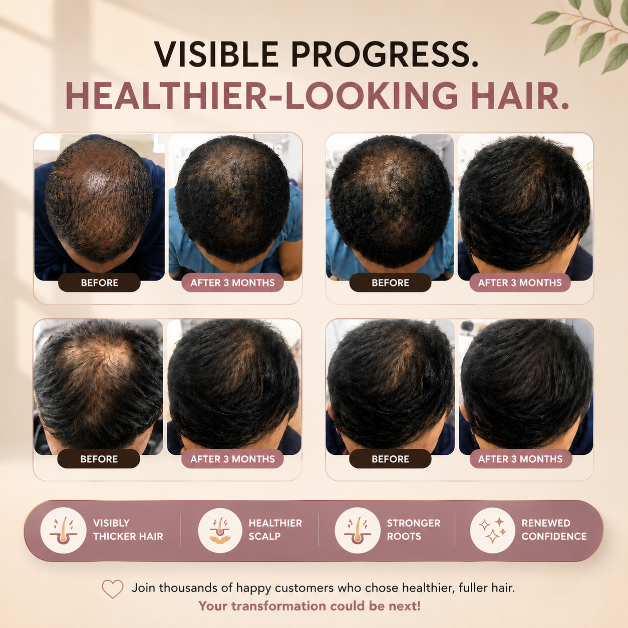 The Ultimate Hair Growth Infusion Kit